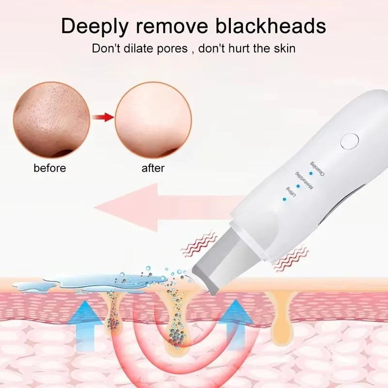 Espatula Ultrasonica Facial 3 En 1